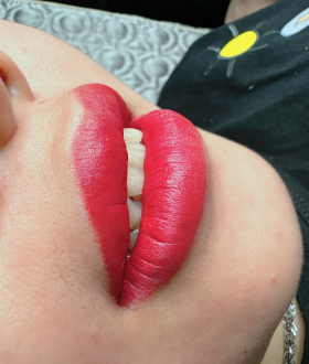 Phun môi thẩm mỹ