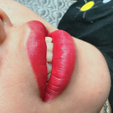 Phun môi thẩm mỹ